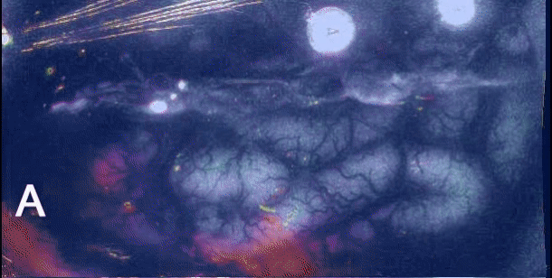 Sequência de imagens de intrinsic optical signal mostrando uma onda de depressão alastrante (spreading depolarization) em cérebro girencefálico, com avanço lento da frente.