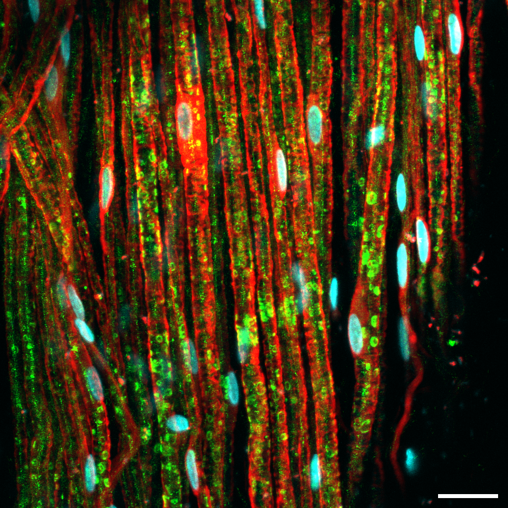 Imunofluorescência confocal de nervo ciático (SNP): bainhas de mielina em verde (MBP), células de Schwann em vermelho (S100) e núcleos em ciano (Hoechst). Escala 25 µm.