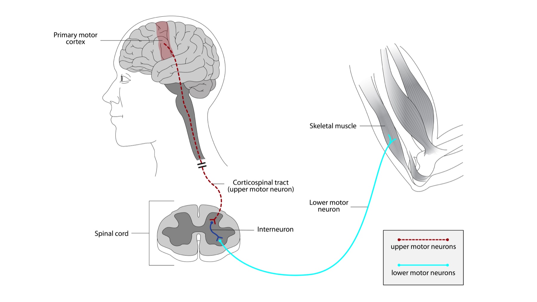 Diagrama da via motora: córtex motor primário e trato corticoespinhal (1º neurônio motor), corte da medula com interneurônio, neurônio motor inferior (2º N) e músculo esquelético do braço