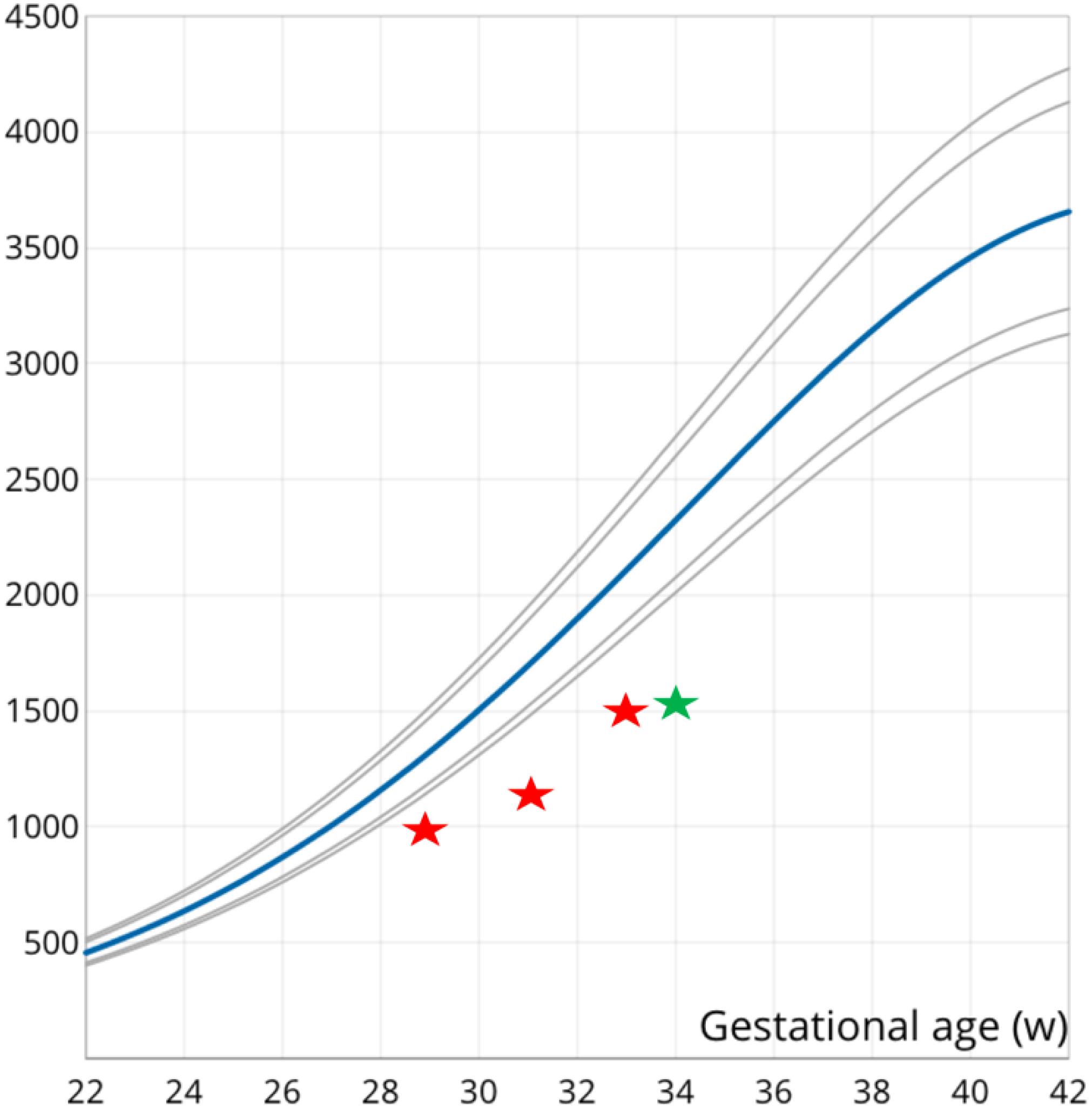 Gráfico de crescimento fetal em ultrassonografia com a biometria plotada abaixo da curva esperada, indicando um feto pequeno.