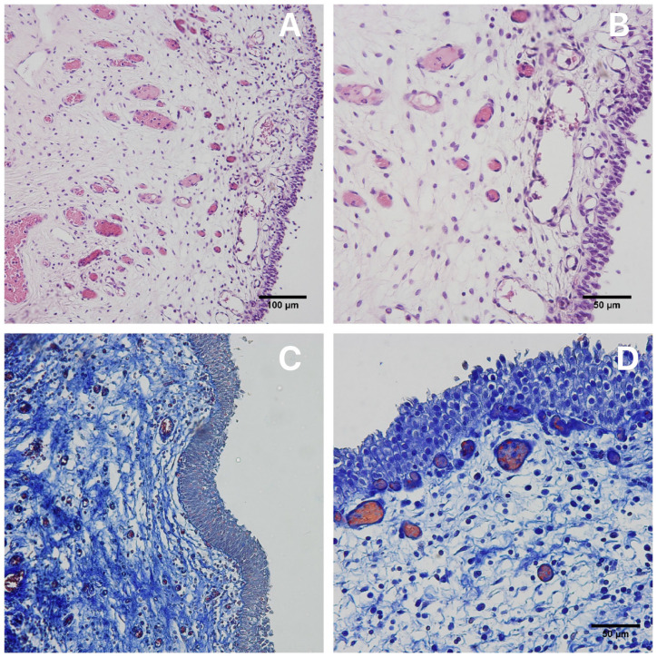 Quatro fotomicrografias de mucosa vesical humana mostrando urotélio íntegro e lâmina própria preservada em H&E e tricrômico de Masson, com barras de 100 e 50 micrômetros.