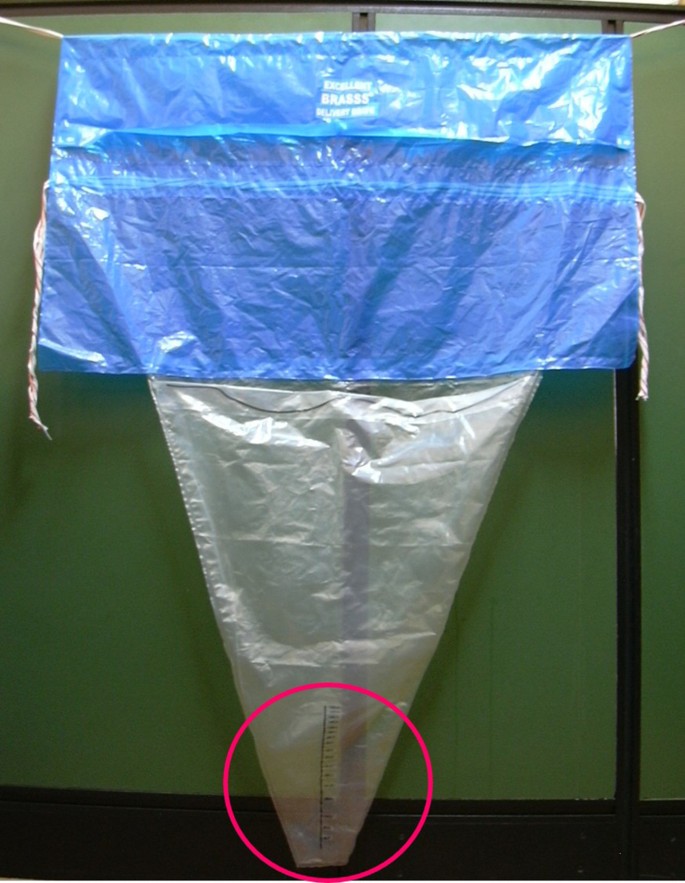 Comparação visual de perda sanguínea estimada — marcos de 500 mL (parto vaginal) e 1000 mL (cesariana).