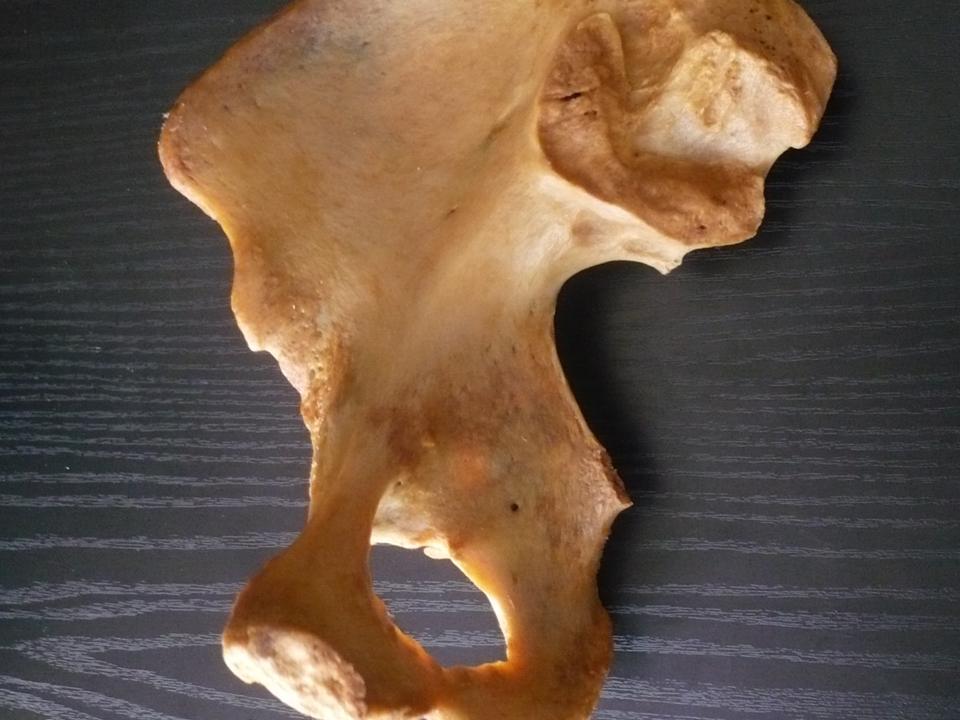 Coxal medial: espinha e tuberosidade isquiáticas