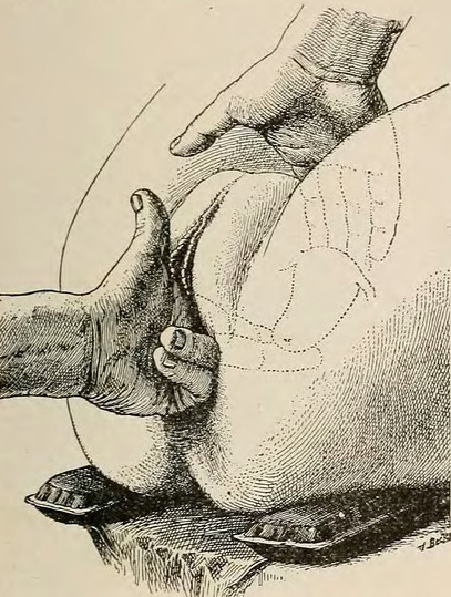 Ilustração histórica do toque bimanual com disposição das mãos e polegar externo.