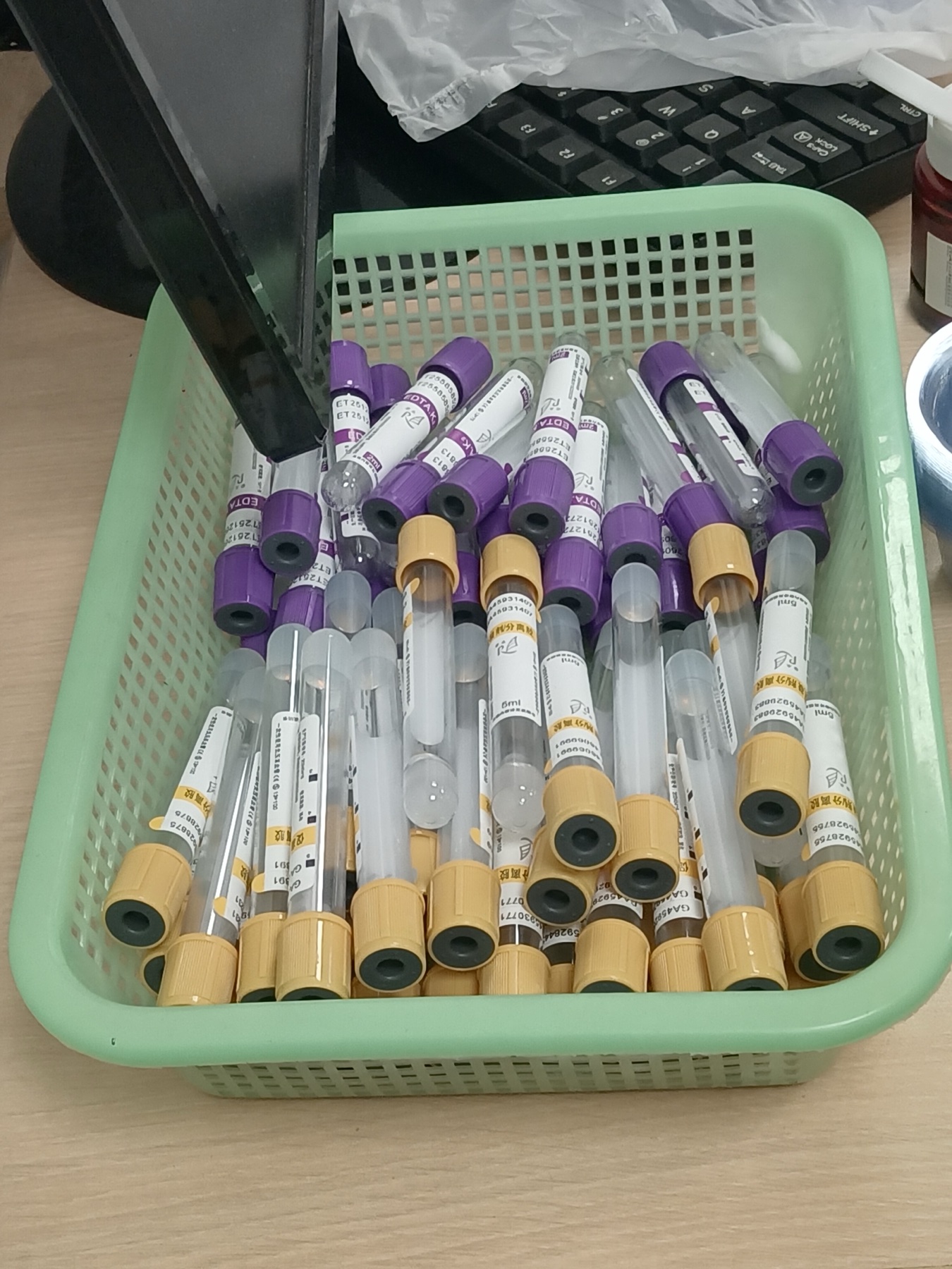 Tubo de coleta sanguínea para exame de função renal (creatinina/ureia).