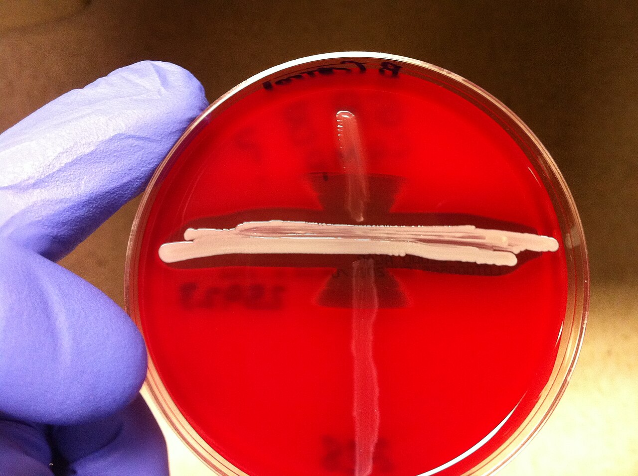 Teste de CAMP para Streptococcus agalactiae (GBS).