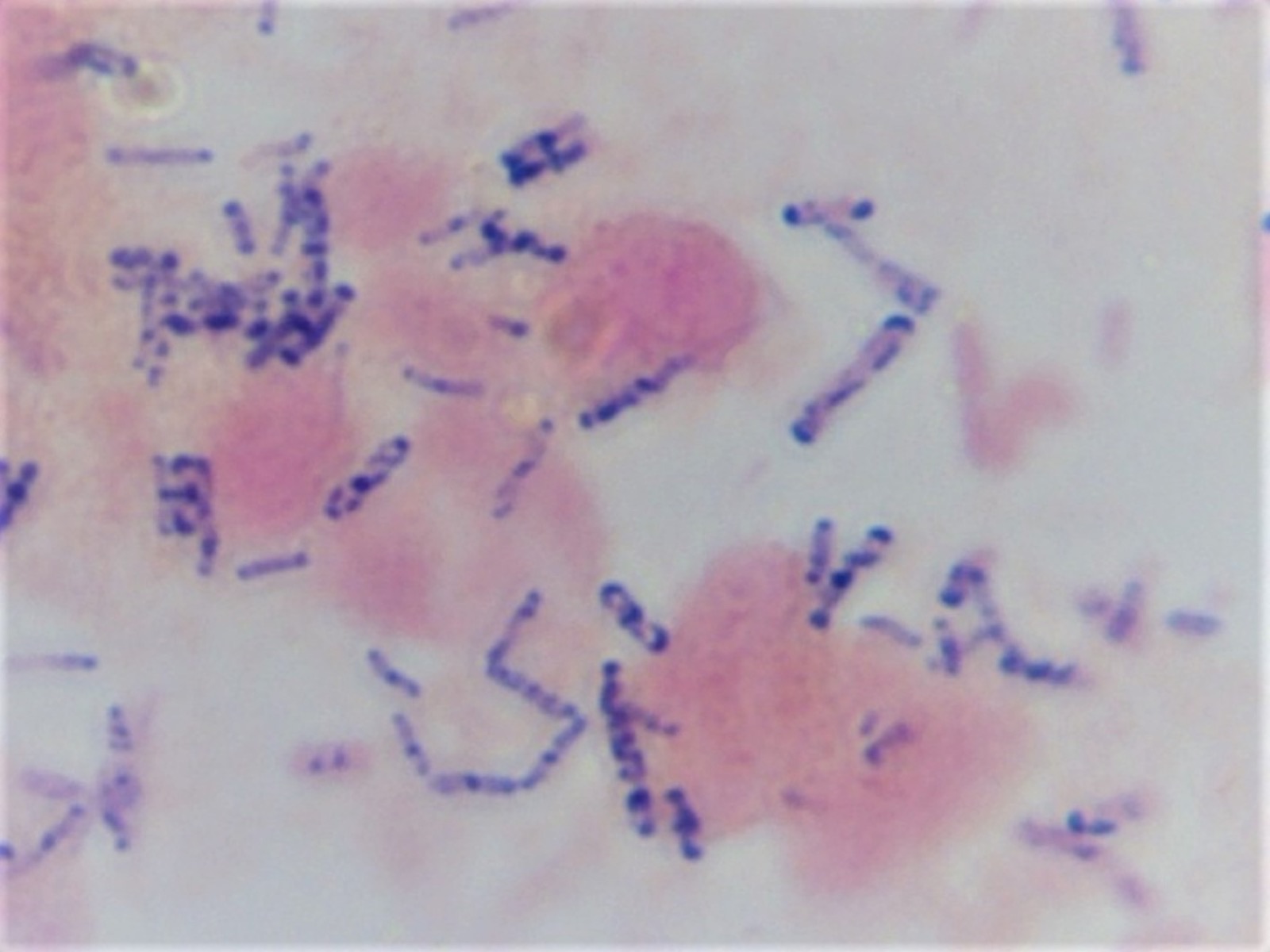Coloração de Gram mostrando cocos gram-positivos dispostos em cadeias, a morfologia característica do gênero Streptococcus.