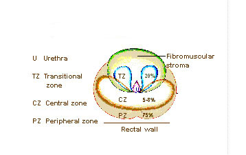 Esquema da anatomia zonal da próstata (modelo de McNeal): zona de transição em volta da uretra e zona periférica posterior, com o reto adjacente.
