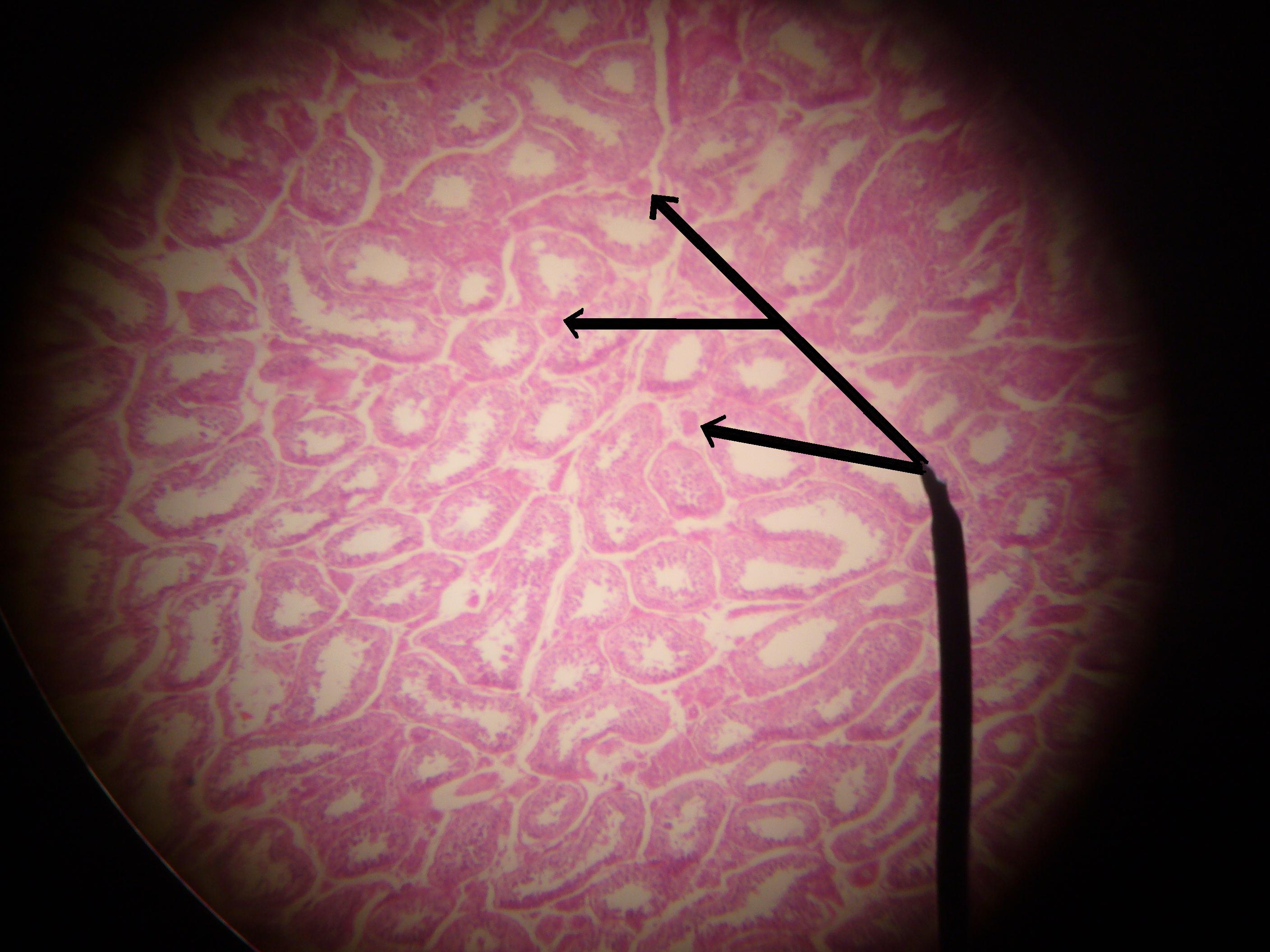 Micrografia histológica do interstício testicular mostrando as células de Leydig, produtoras de testosterona.