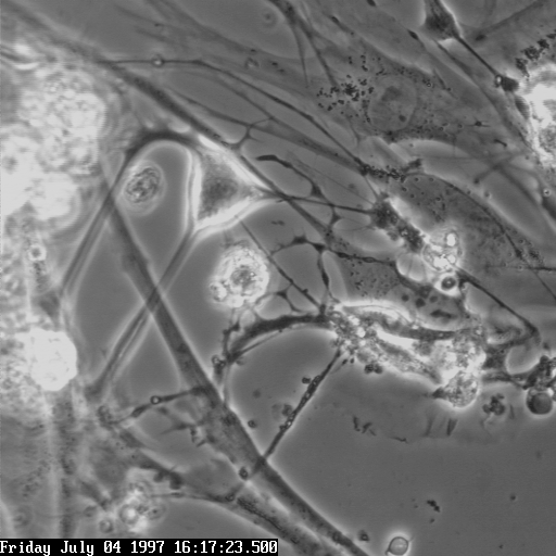 Microscopia de contraste de fase mostrando célula intersticial de Cajal isolada em cultura, com corpo celular estrelado e longos prolongamentos ramificados.