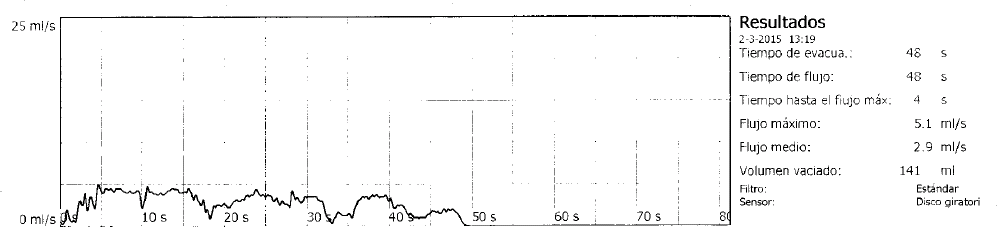 Traçado de urofluxometria com padrão obstrutivo: curva de fluxo achatada, fluxo máximo de 5,1 ml/s e micção prolongada de 48 segundos.