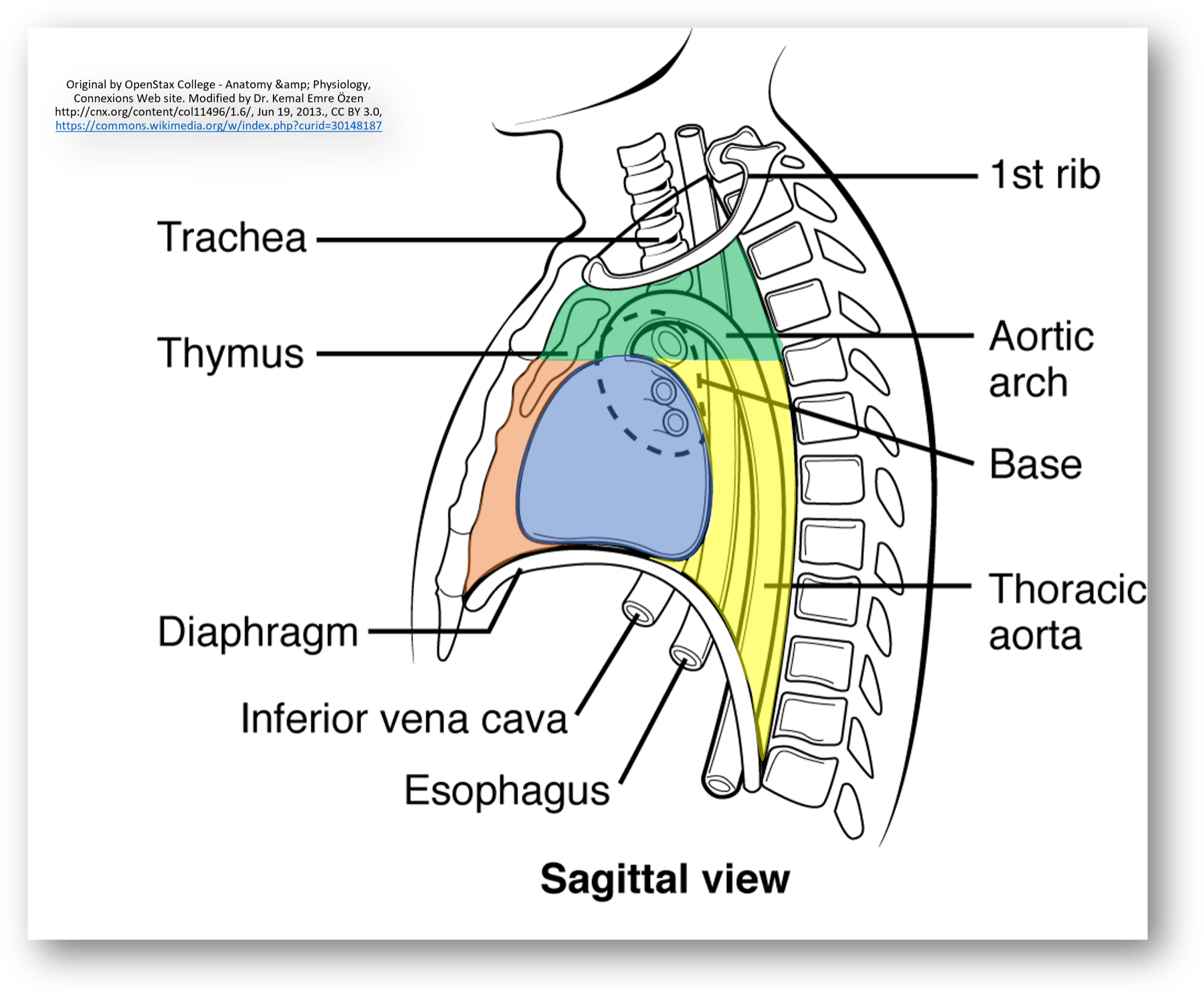 Diagrama anatômico do mediastino em corte lateral, com os compartimentos coloridos: superior (verde), anterior (laranja), médio (azul) e posterior (amarelo).