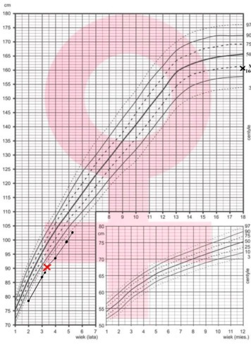 Curva de estatura de menina com medições seriadas plotadas em um canal baixo do gráfico, com marcação de idade óssea e inset de velocidade de crescimento.