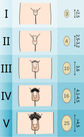 Diagrama esquemático dos estágios genitais masculinos de G1 a G5, com os volumes testiculares correspondentes, destacando a peça de 4 mL no estágio II.