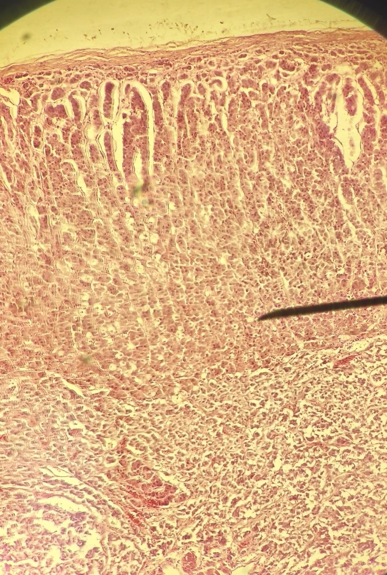 Corte histológico do córtex adrenal corado por hematoxilina-eosina, mostrando, da cápsula para a medula, as zonas glomerulosa, fasciculada e reticular.