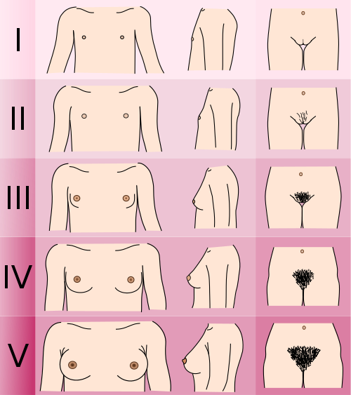 Diagrama esquemático dos estágios de Tanner femininos: mamas de M1 a M5 e pelos de P1 a P5, com o duplo contorno destacado em M4.