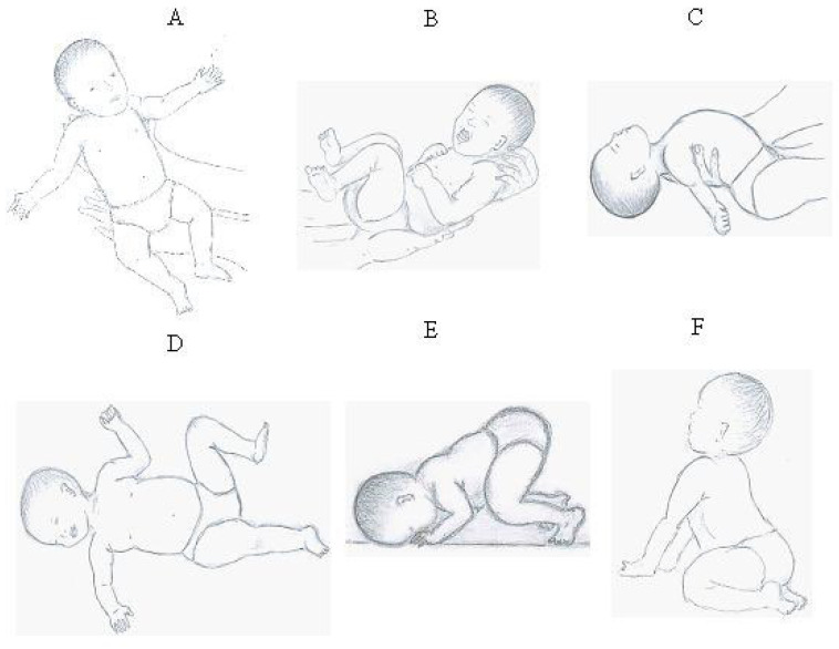 Prancha ilustrada de reflexos primitivos (figura de artigo open access): painel mostrando o reflexo de Moro (abertura/abdução dos braços) e o reflexo tônico-cervical assimétrico em postura de esgrimista; ilustração, não foto de menor.