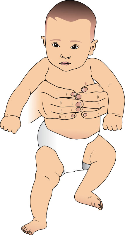 Ilustração de lactente sustentado em pé com uma perna apoiada e outra em flexão, compatível com a marcha automática (stepping reflex); ilustração de livro-texto, não foto de menor identificável.